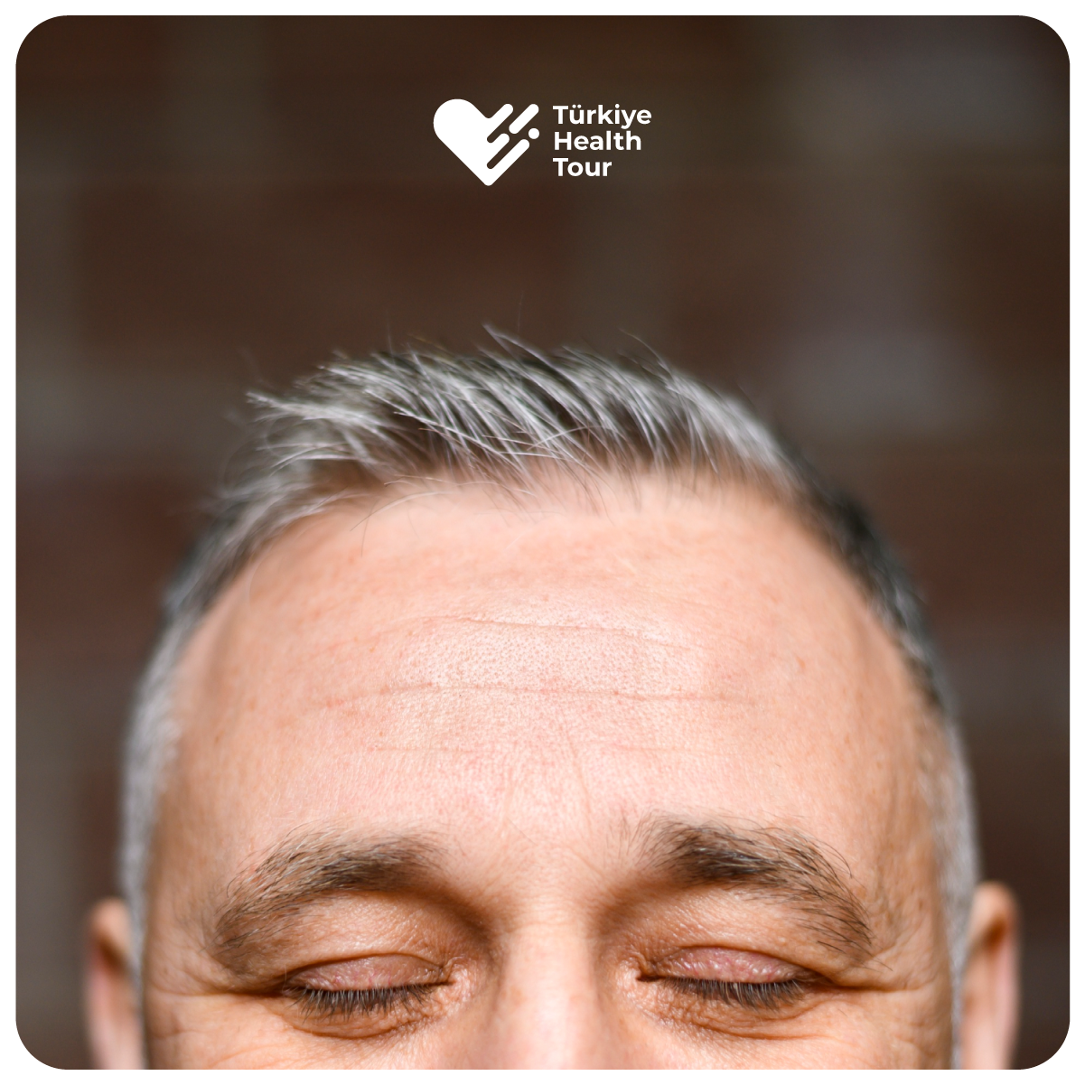 https://turkiyehealthtour.com/wp-content/uploads/2026/03/Hair-Transplantation.png
